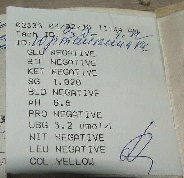 A vizeletanalízisem a femixal előtti eredmények